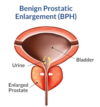 FLX MORNING PODCAST – Dr. David Schnapp, AMP Urology