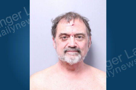 A middle-aged man with messy hair, a beard, a black eye, and facial cuts poses shirtless for a mugshot against a plain background.