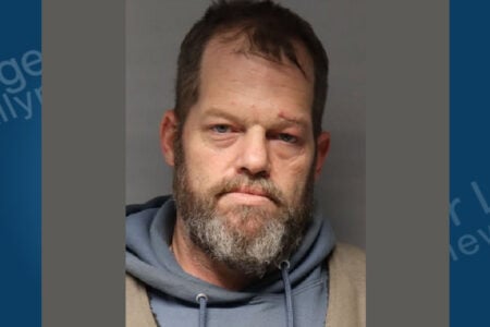 Mugshot of a bearded man with a cut above his left eye and swelling around his right eye, looking straight ahead.