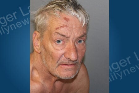 Bare-chested older man with disheveled grey hair, blue eyes, and forehead injuries looks directly at the camera.